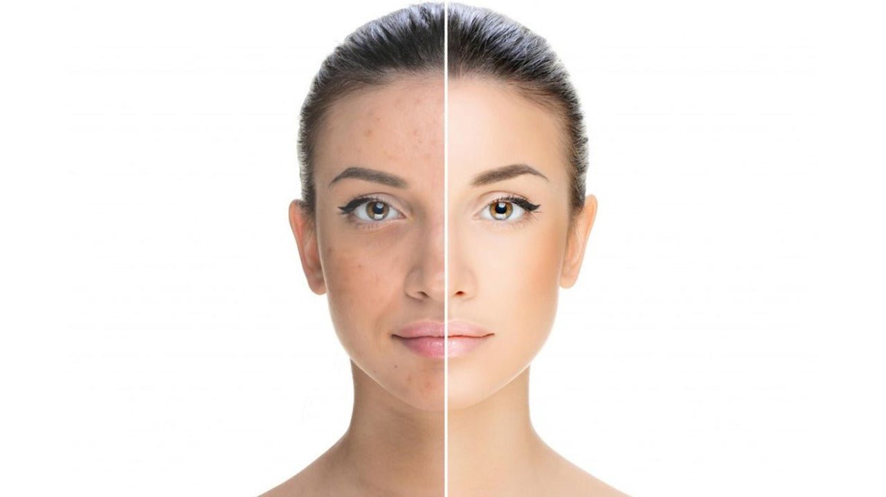 glutathione skin color What is Glutathione? Do you know that it is Skin Whitening Agent? – ChiltanPure