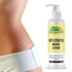 CHILTAN PURE Anti-Stretch Marks Lotion 150ml Price in Pakistan - Body Moisturizer