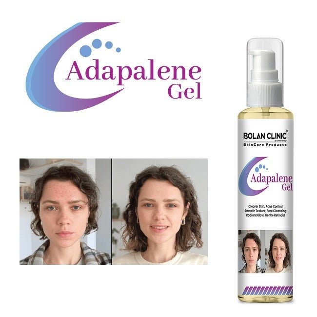Adapalene Gel / ایڈاپیلین جیل - ChiltanPure