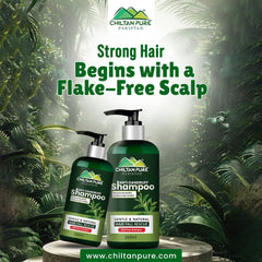 Anti Dandruff Shampoo – Strengthens Hair, Eliminate Wet Dandruff, Soothes Scalp Itching & Contains Anti - Dandruff Properties - ChiltanPure