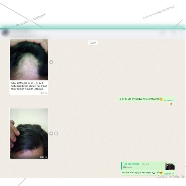 Balchar (Jatamansi) Oil – Effective for Alopecia, Enlarges Follicular Hair Size & Prevents Scalp Infections - ChiltanPure