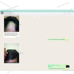 Balchar (Jatamansi) Oil – Effective for Alopecia, Enlarges Follicular Hair Size & Prevents Scalp Infections - ChiltanPure