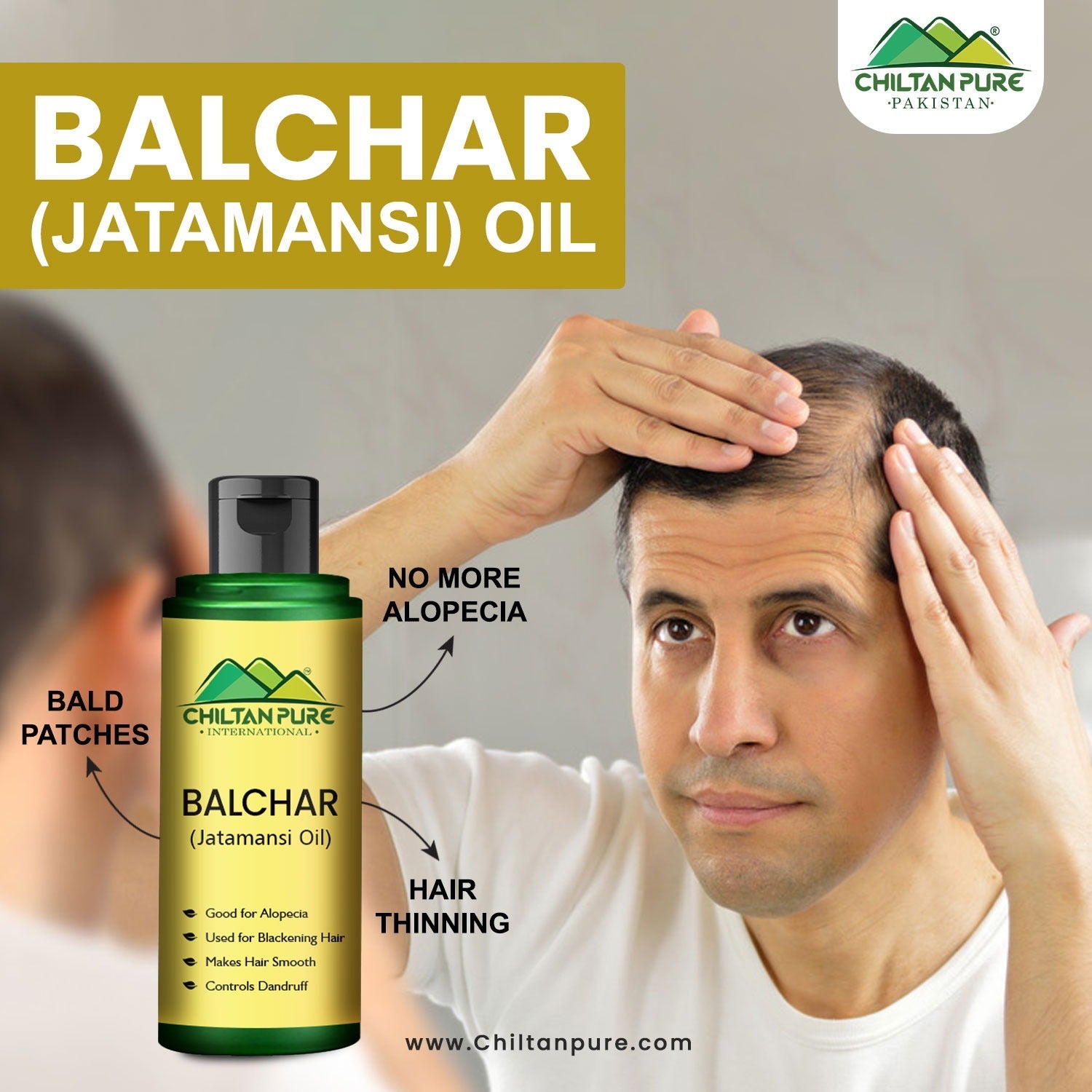Balchar (Jatamansi) Oil – Effective for Alopecia, Enlarges Follicular Hair Size & Prevents Scalp Infections - ChiltanPure