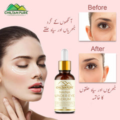 Naina Under Eye Serum – For Firm Delicate Skin, Support firm refreshed look – Reduce fine lines, Dark circles & Puffiness (100% result)