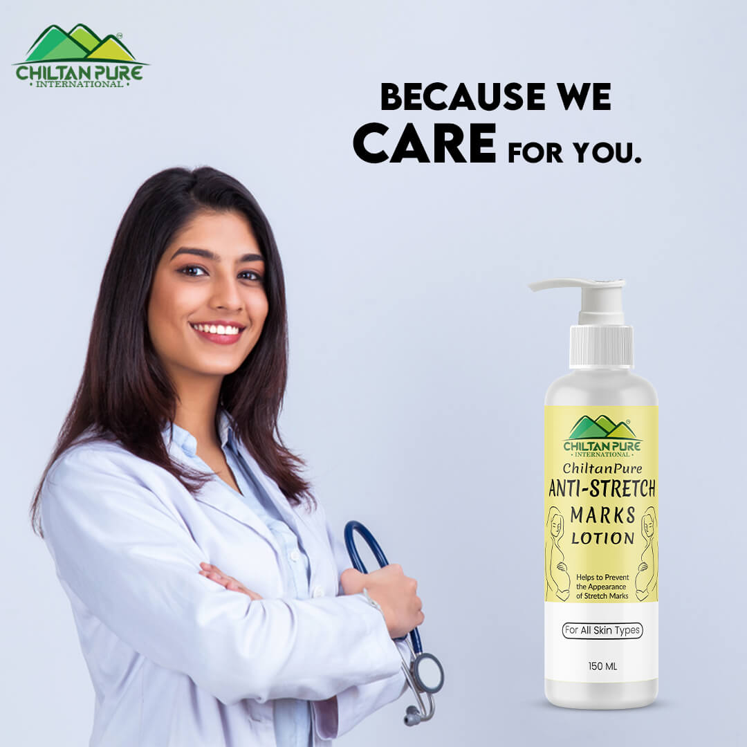 Anti-Stretch Marks Lotion – Formulated To Repair, Diminish & Prevent Stretch Marks With Intense Hydration & Smoothing, Good For Pregnancy Skincare 150ml - ChiltanPure