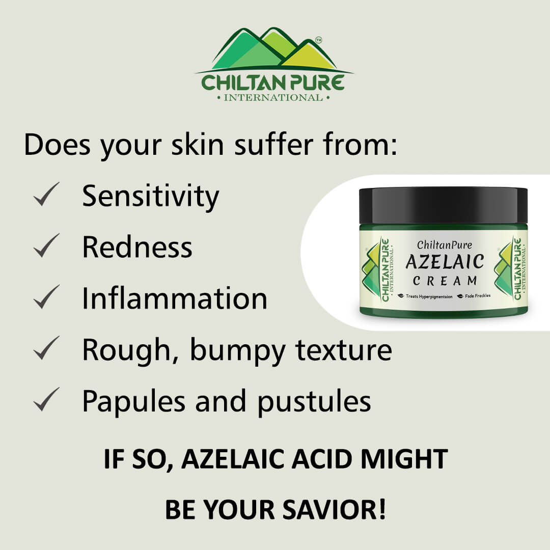 Azelaic Cream – Antibacterial, Lighten Freckles, Reduce Hyperpigmentation & Fade Acne Scars 50ml - ChiltanPure