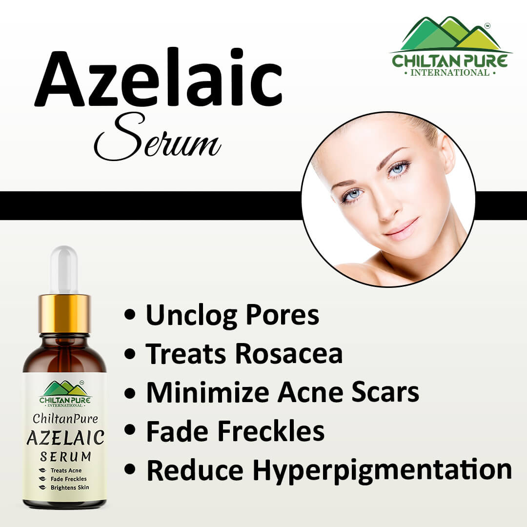 Azelaic Serum - Brightens Skin, Treats Acne, Unclogs Pores, Fade Freckles & Lighten Acne Scars!! - ChiltanPure