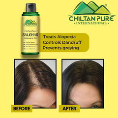 Balchar (Jatamansi) Oil – Effective for Alopecia, Enlarges Follicular Hair Size & Prevents Scalp Infections - ChiltanPure