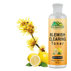 Blemish Clearing Toner – Soothes Redness & Inflammation, Fights with Acne & Helps Prevent Breakouts, Good For All Skin Types 150ml - ChiltanPure