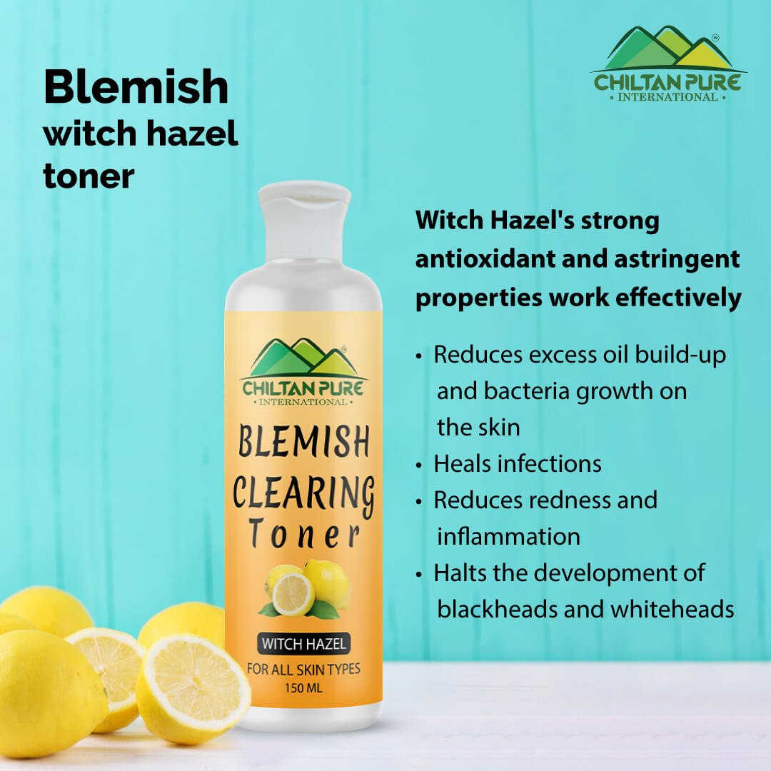Blemish Clearing Toner – Soothes Redness & Inflammation, Fights with Acne & Helps Prevent Breakouts, Good For All Skin Types 150ml - ChiltanPure