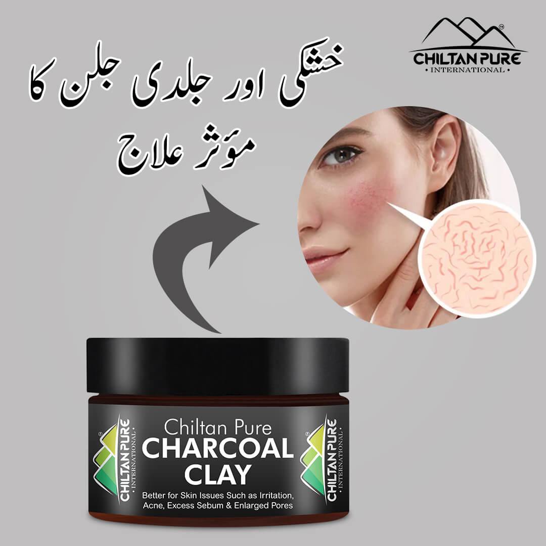Charcoal Clay – Help absorb excess oil from skin, clean out your pores, prevent acne breakouts 200gm - ChiltanPure