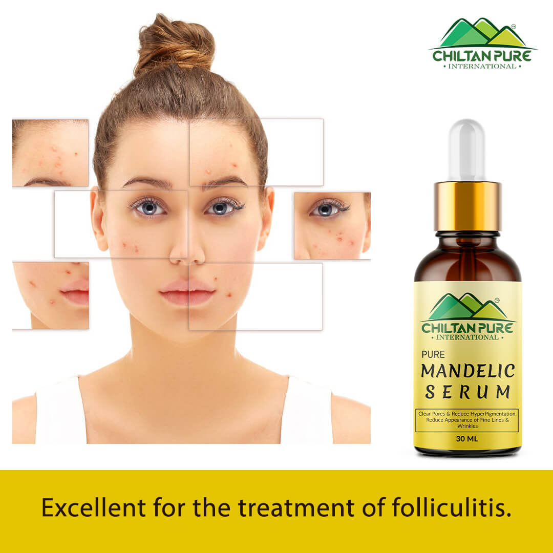 Mandelic Serum - Get Brighter & Luminous Complexion - ChiltanPure