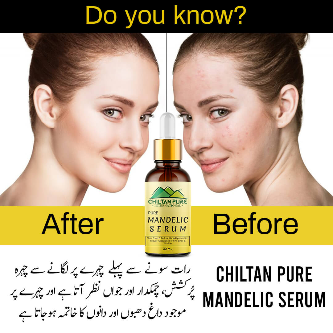 Mandelic Serum - Get Brighter & Luminous Complexion - ChiltanPure
