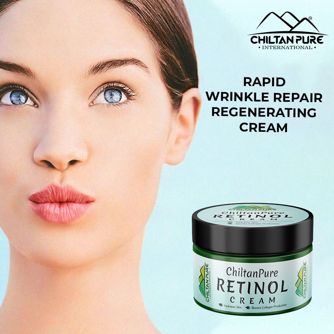 Retinol Cream – Hydrates Skin, Treats Severe Acne, Stimulates Collagen Production & Reduce Fine lines - ChiltanPure