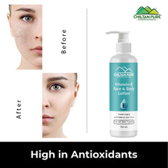 Vitamin-E Lotion - Used as a Moisturizer To Treat or Prevent Dry, Rough, Scaly, Itchy Skin & Minor Skin Irritations (e.g., Diaper rash, Skin Burns From Radiation Therapy) - ChiltanPure