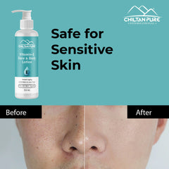 Vitamin-E Lotion - Used as a Moisturizer To Treat or Prevent Dry, Rough, Scaly, Itchy Skin & Minor Skin Irritations (e.g., Diaper rash, Skin Burns From Radiation Therapy) - ChiltanPure