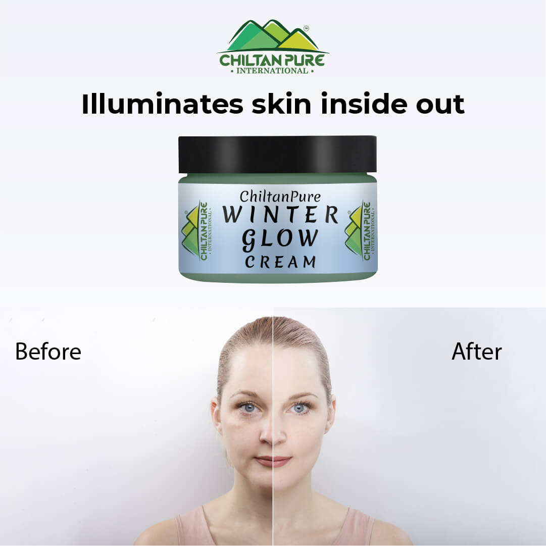 Winter Glow Cream – Formulated With Multivitamins & Moisturizers, Makes Skin Soft & Supple, Good For Dry & Dehydrated Skin - ChiltanPure