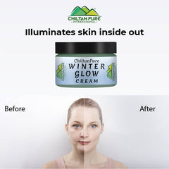 Winter Glow Cream – Formulated With Multivitamins & Moisturizers, Makes Skin Soft & Supple, Good For Dry & Dehydrated Skin - ChiltanPure