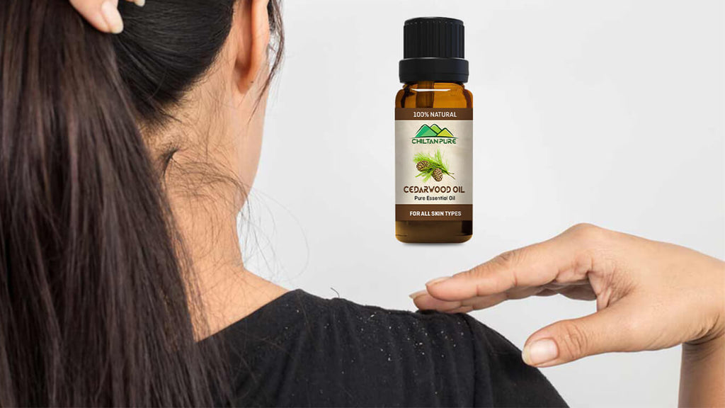 14 Amazing Cedarwood Oil Benefits for Skin, Hair & Health