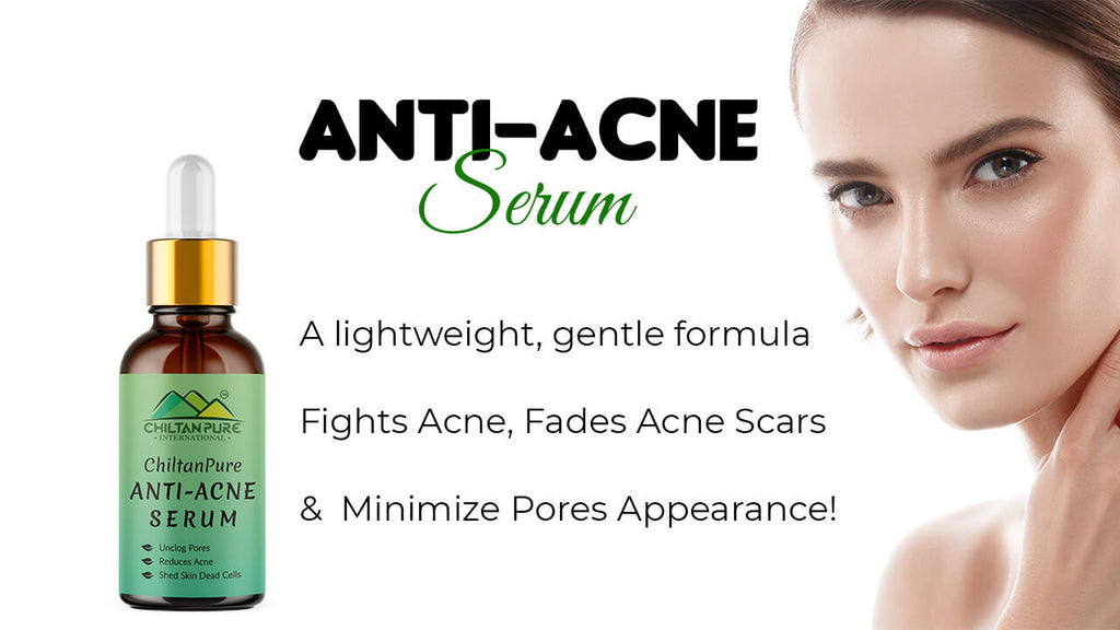 Anti-Acne Serum - A lightweight, gentle formula, Fights Acne, Fades Acne Scars &amp; Minimize Pores Appearance