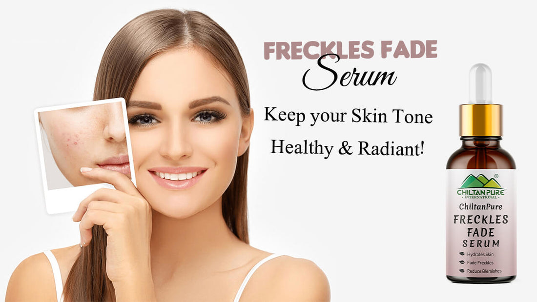 Freckles Fade Serum - Keep your Skin Tone Healthy &amp; Radiant!! - ChiltanPure