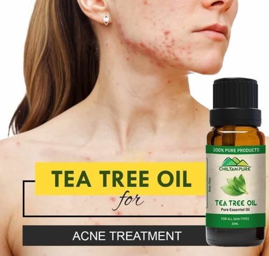 Tea Tree Oil Uses: Benefits for Skin & Hair - ChiltanPure