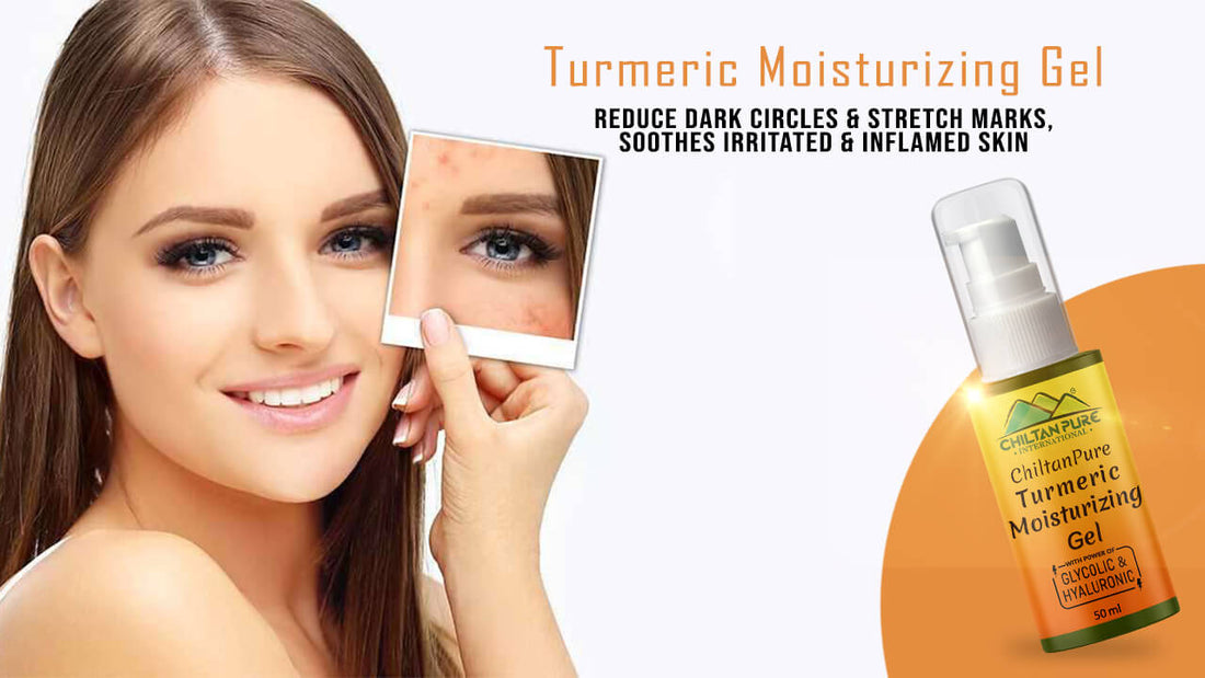Turmeric Moisturizing Gel – Reduce Dark Circles & Stretch Marks, Soothes Irritated & Inflamed Skin - ChiltanPure