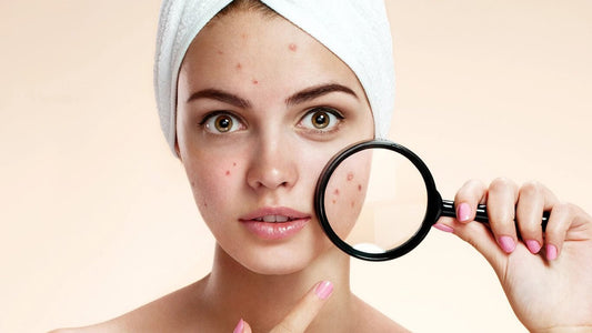 What is Glycolic Acid? What It Can Actually Do to Your Skin ? - ChiltanPure