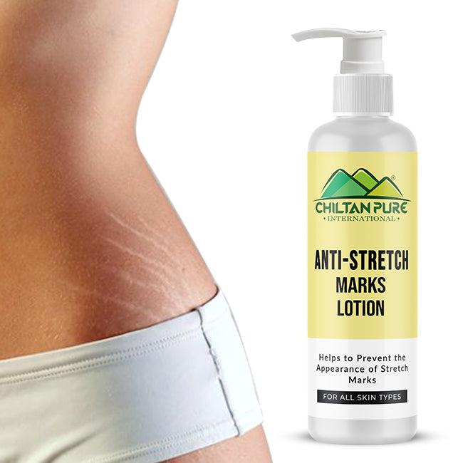 Anti-Stretch Marks Lotion – Formulated To Repair, Diminish & Prevent Stretch Marks With Intense Hydration & Smoothing, Good For Pregnancy Skincare 150ml
