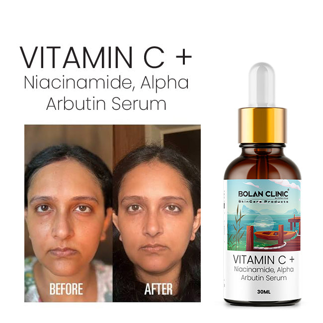 Vitamin C + Face Serum