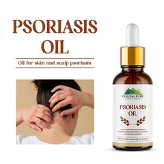 Psoriasis Oil / سورائسس آئل