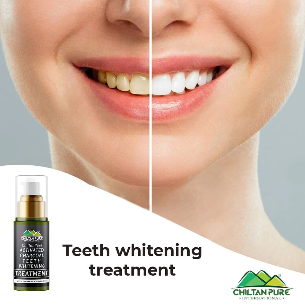 Activated charcoal oral care treatment by CHILTAN PURE Pakistan