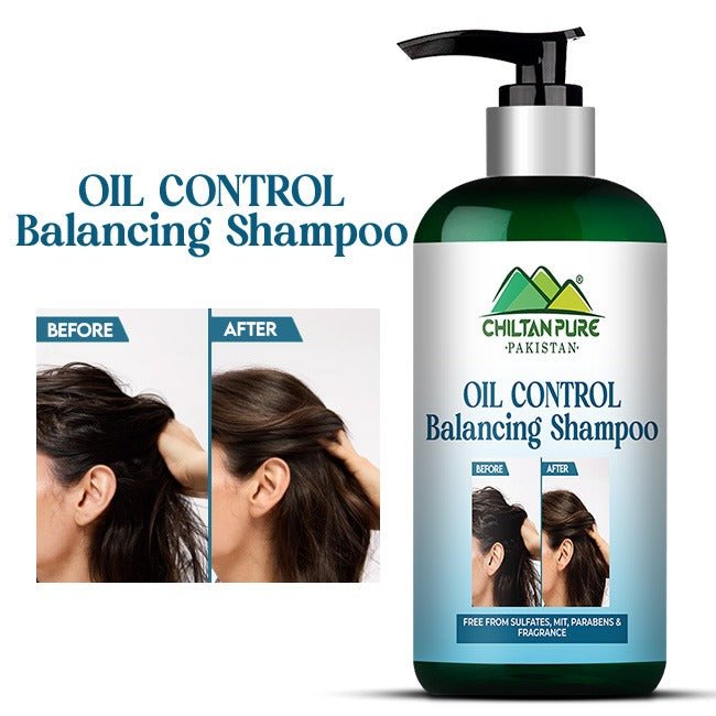 Oil Control Balancing Shampoo / Specially Formulated to Manage Excess Oil on the Scalp - ChiltanPure