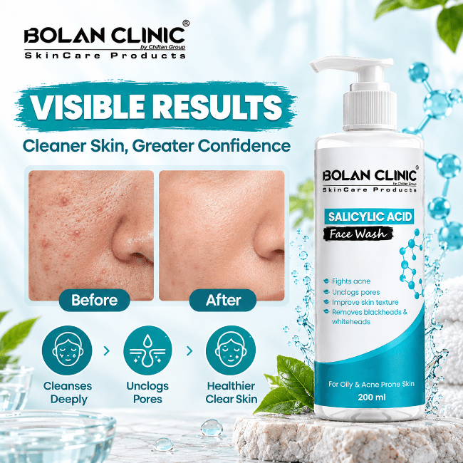 Salicylic Acid Face Wash – Fights Acne, Removes Blackheads & Whiteheads - ChiltanPure