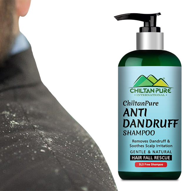 Anti Dandruff Shampoo – Strengthens Hair, Eliminate Wet Dandruff, Soothes Scalp Itching & Contains Anti-Dandruff Properties