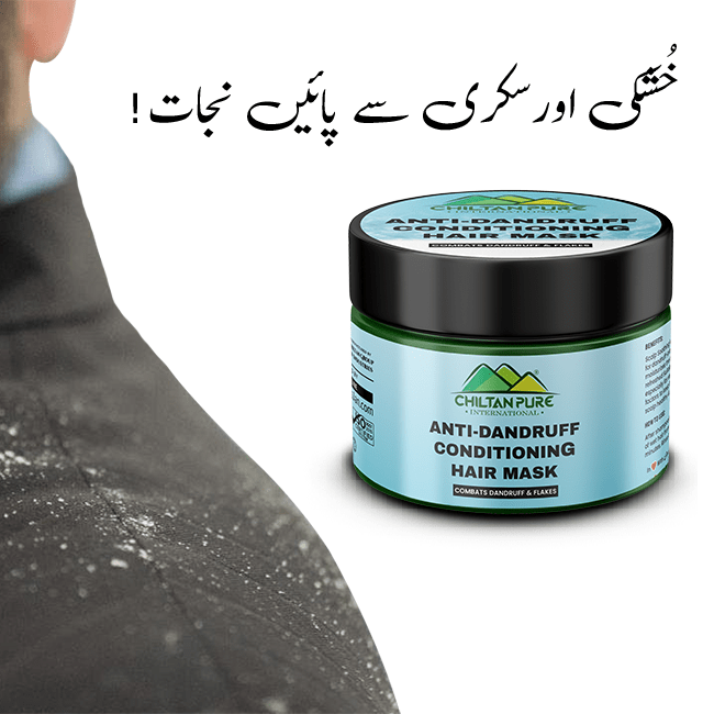 Anti Dandruff Conditioning Hair Mask – Formulated For Dandruff-Prone Scalp, Makes Hair Shiny & Soft 250ml - ChiltanPure