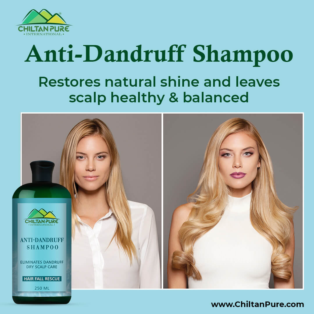 Anti Dandruff Shampoo – Strengthens Hair, Eliminate Wet Dandruff, Soothes Scalp Itching & Contains Anti-Dandruff Properties 250ml - ChiltanPure
