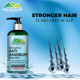 Anti Dandruff Shampoo – Strengthens Hair, Eliminate Wet Dandruff, Soothes Scalp Itching & Contains Anti-Dandruff Properties - ChiltanPure