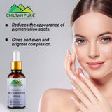 Anti-Pigmentation Serum – Brighten Skin, Lighten Pigmentation, Fade Freckles & Even Skin Tone 30ml - ChiltanPure