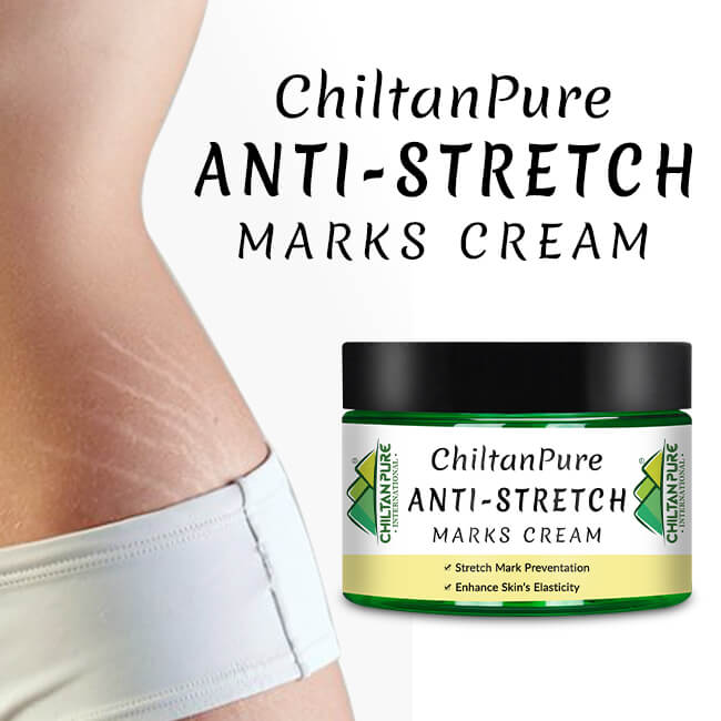 4 Incredible Stretch Mark Serum Benefits You Need To Know