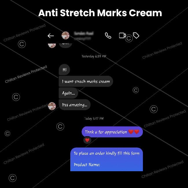 Anti-Stretch Marks Cream – Formulated With Shea Butter, Coco Butter & Vitamin E, Prevent Scars & Stretch Marks With Intense Hydration & Smoothing - ChiltanPure