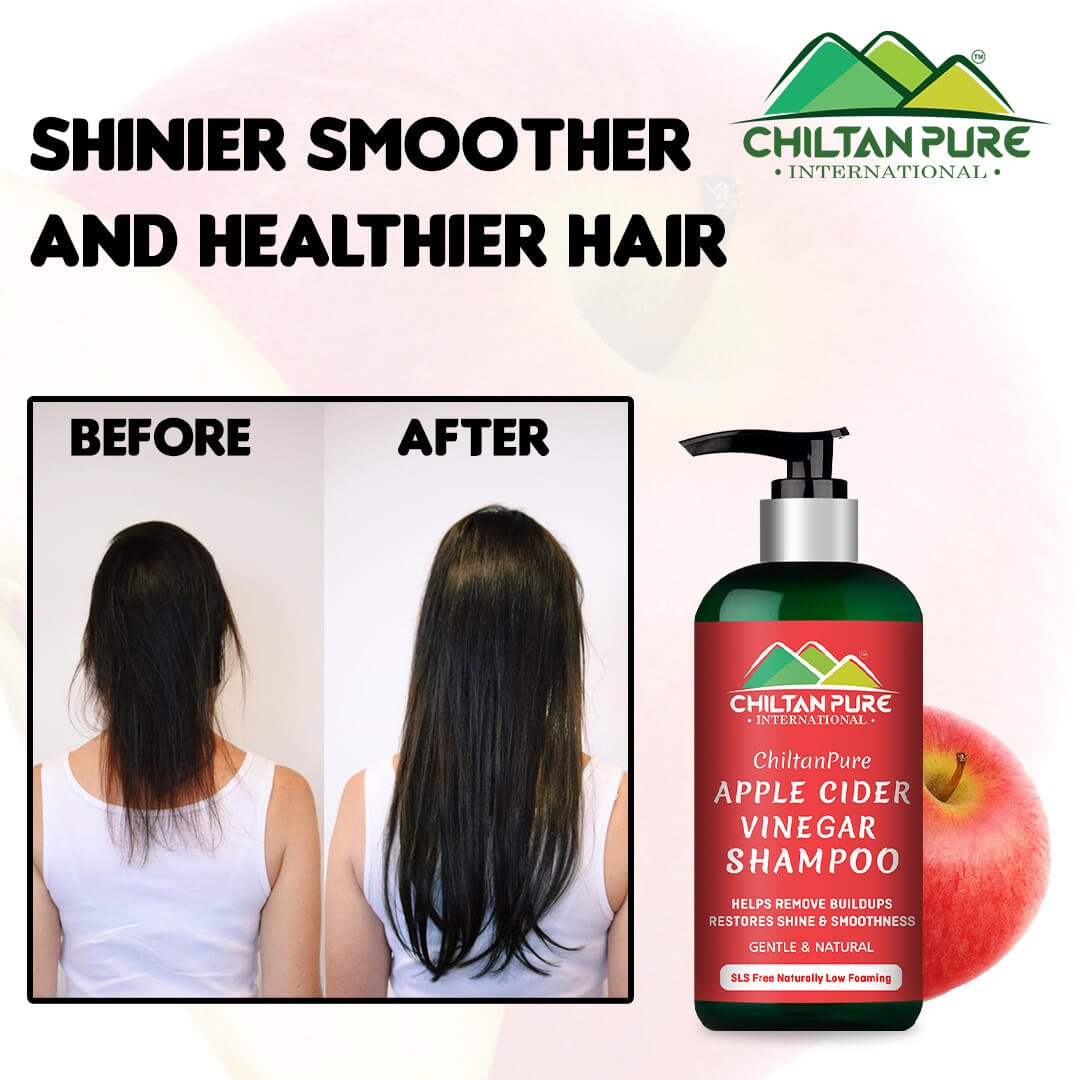 Apple Cider Vinegar Shampoo – Enhance Hair Shine, Balance PH Level of Hair, Promote Hair Growth & Strengthen Hair Follicles 250ml - ChiltanPure