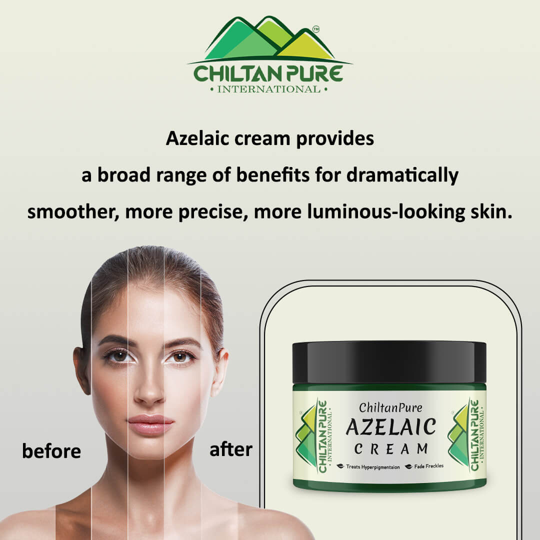 Azelaic Cream – Antibacterial, Lighten Freckles, Reduce Hyperpigmentation & Fade Acne Scars 50ml - ChiltanPure