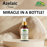 Azelaic Serum - Brightens Skin, Treats Acne, Unclogs Pores, Fade Freckles & Lighten Acne Scars!! - ChiltanPure