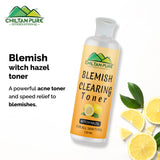Blemish Clearing Toner – Soothes Redness & Inflammation, Fights with Acne & Helps Prevent Breakouts, Good For All Skin Types 150ml - ChiltanPure