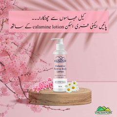 Calamine Lotion – Solution to every allergy, contains anti-allergic properties, Reduces skin dryness – 100% organic 150ml - ChiltanPure