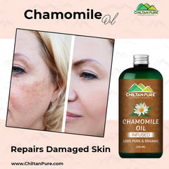 Chamomile Oil – Give Healthy Look to Your Face & Hair With This Majestic Liquid [بابونہ] 250ml - ChiltanPure