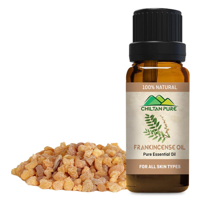 Frankincense Essential Oil – Best for Removing Dark Circles 20ml - ChiltanPure