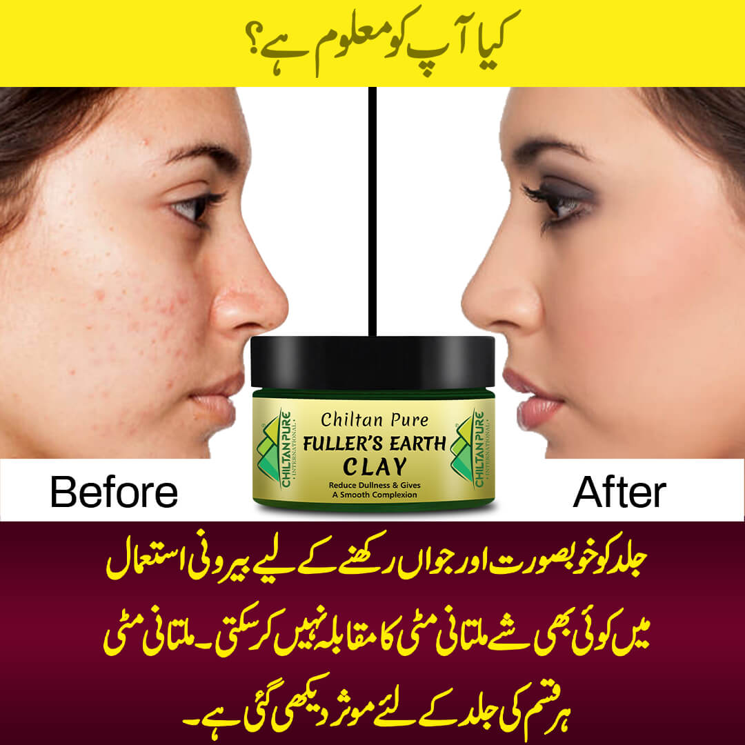 Fuller's Earth Clay - Acne Fighter Clay [Multani Mitti][For Oily Skin] 250g - ChiltanPure