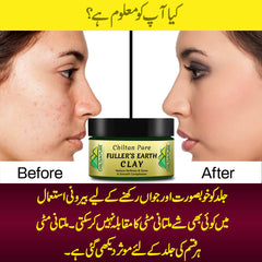 Fuller's Earth Clay - Acne Fighter Clay [Multani Mitti][For Oily Skin] 250g - ChiltanPure